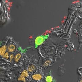 Simulation of Viral/Bacterial Pneumonia in a Human Lung Tissue Model