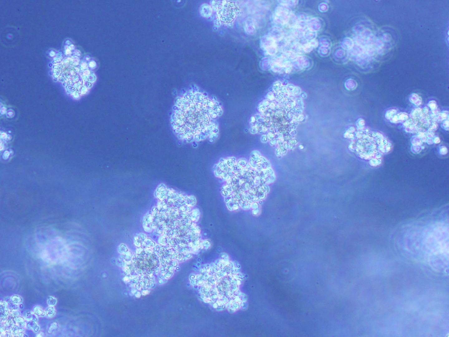 Cancer Cells Before Treatment