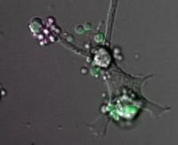 Phagocyte Eating Dying Cells