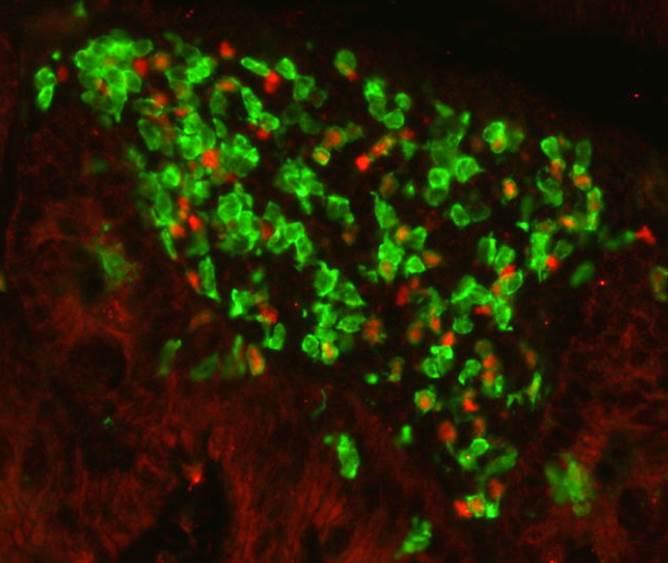 A Cluster of Type 3 Cells in a Mouse Colon