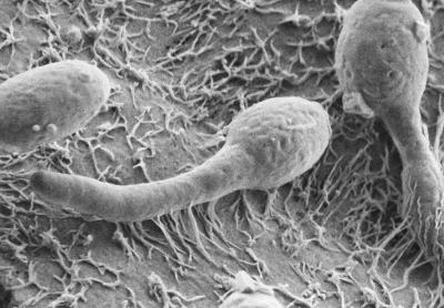 Tracking Down Pathogenic Yeasts