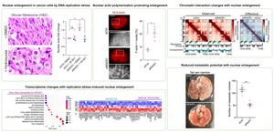 KAIST, Cancer Cell Nuclear Hypertrophy May Suppress Spread​