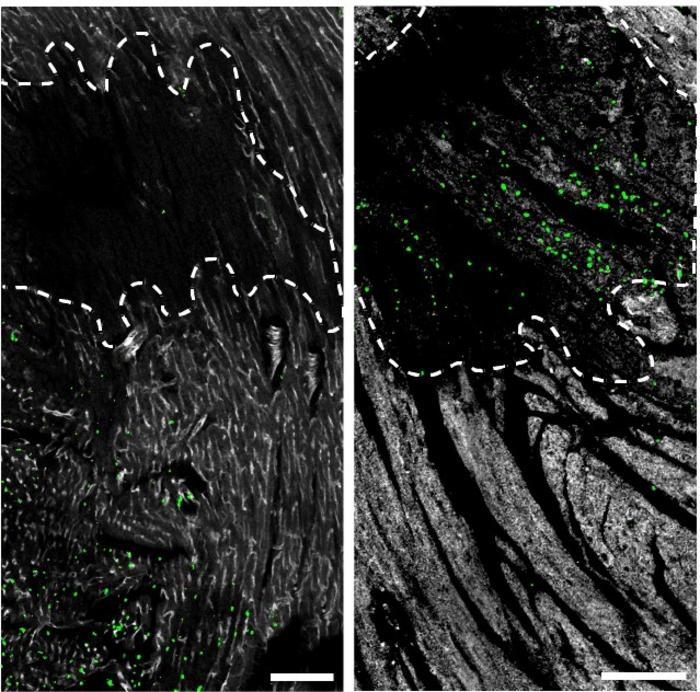 Inhibiting the neutrophil clock alters their position and activity in wounded tissue