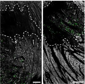 Inhibiting the neutrophil clock alters their position and activity in wounded tissue