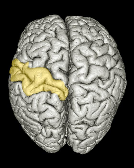 MRI Scan of the brain of the physician Conrad Heinrich Fuchs.