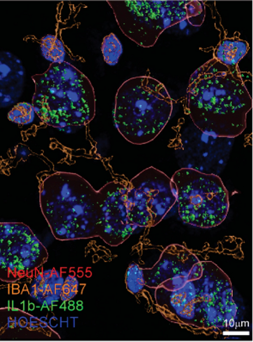 Interleukin 1β