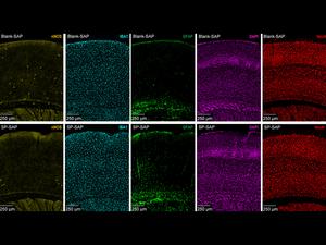 Blood flow regulation