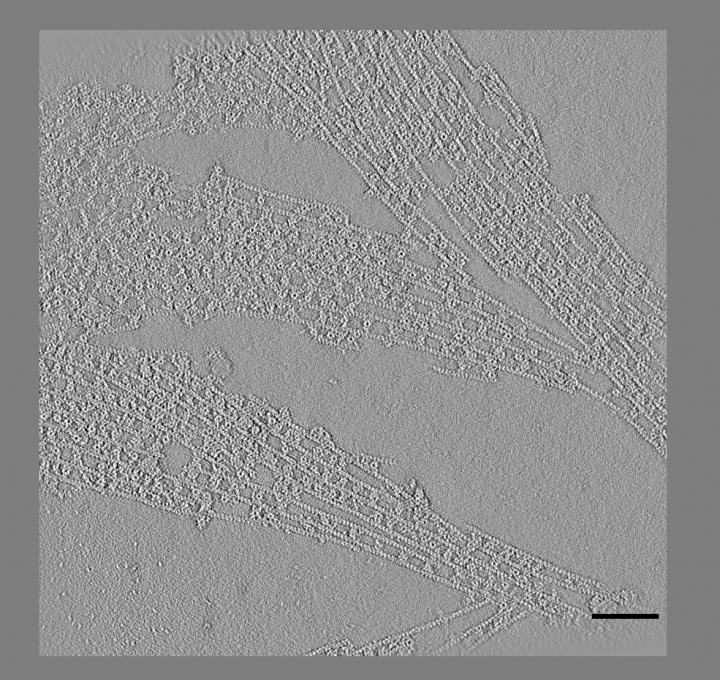 Actin (3 of 3)