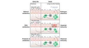 Study reveals high stakes of early immune development—and a potential probiotic fix