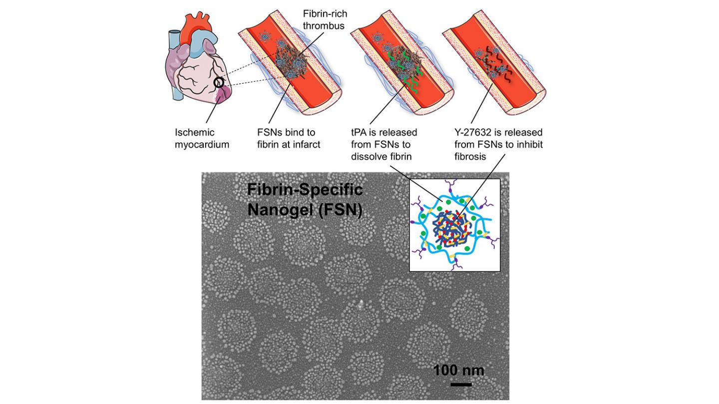 Targeted Drug-Delivery Allows Rapid Response to Heart Attacks