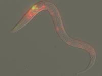 C. Elegans Under A Microscope (Second View)