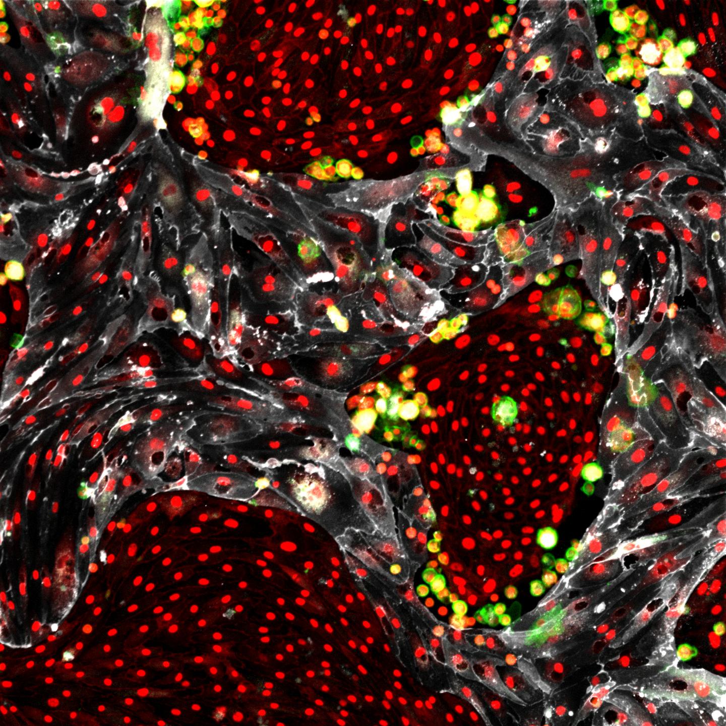 Weill Cornell Medicine Team Creates Self-Renewing Hematopoietic Stem Cells for Transplantation