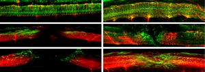 Nerve cells grow thanks to the microrobots