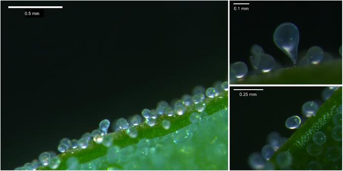 Bladder cells