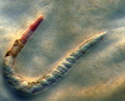 Red Death in Worm