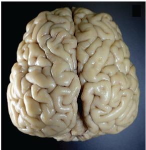 Sea lion brain