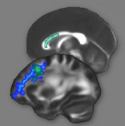 Brain Scans