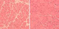 Improved Muscle Regeneration in Aged Mice