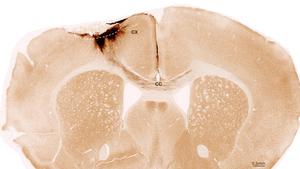 Mouse brain after stroke and neural stem cell transplantation
