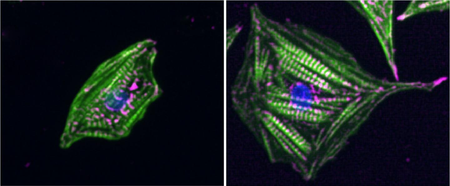 Heart Cells