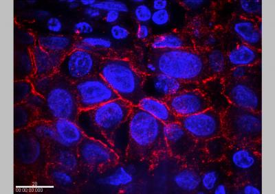 NIST, NCI, SAIC Partner on New Method for Detecting HER2 Breast Cancer (1 of 2)