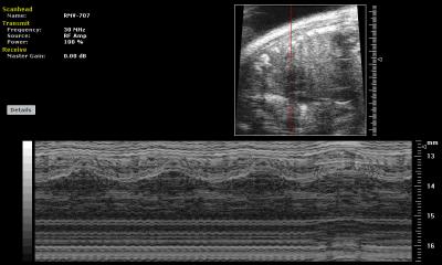 Chest with Heartbeat