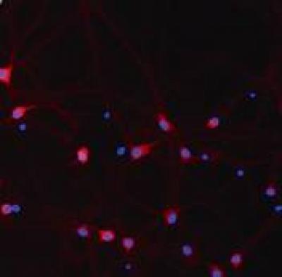 Hippocampal Neurons