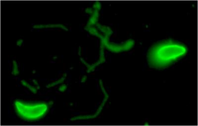 Taoxoplasma Parasites
