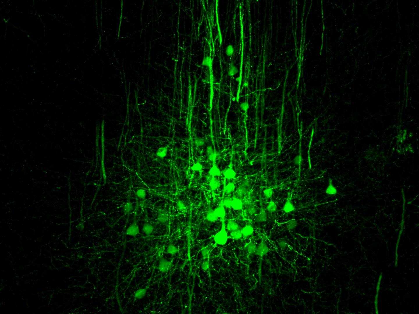 Physical Positioning Dramatically Enhances Brain Transduction After Intrathecal AAV9 Infusion (1-7)