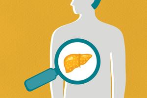 Parental obesity and risk of liver disease