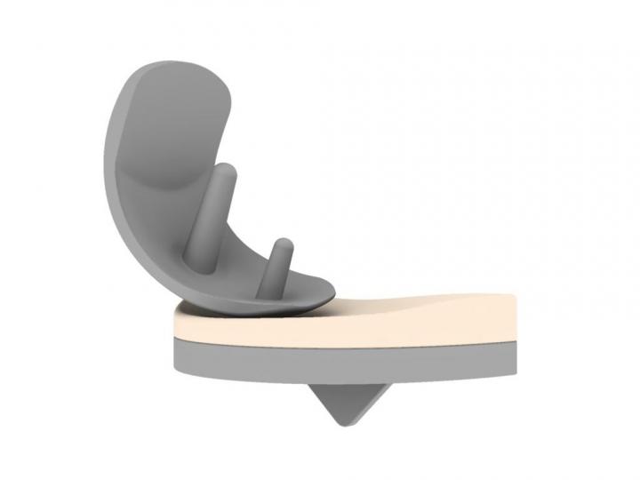 Implant Design
