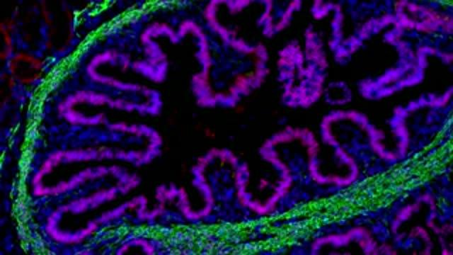 Can Scientists Custom Grow Organs?