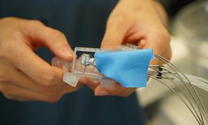 Dental robot mounted on a custom-fitted dental splint