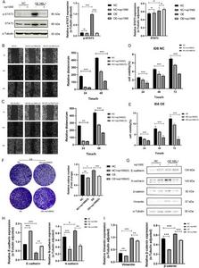 Wp1066 could reverse the tumor-promoting effect of NBL1 overexpression.
