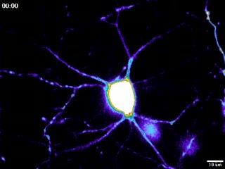 Colorful New Era of Calcium Imaging (2 of 3)