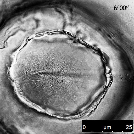 Spermatozoon in Contact with an Oocyte Membrane