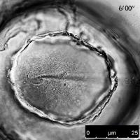 Spermatozoon in Contact with an Oocyte Membrane