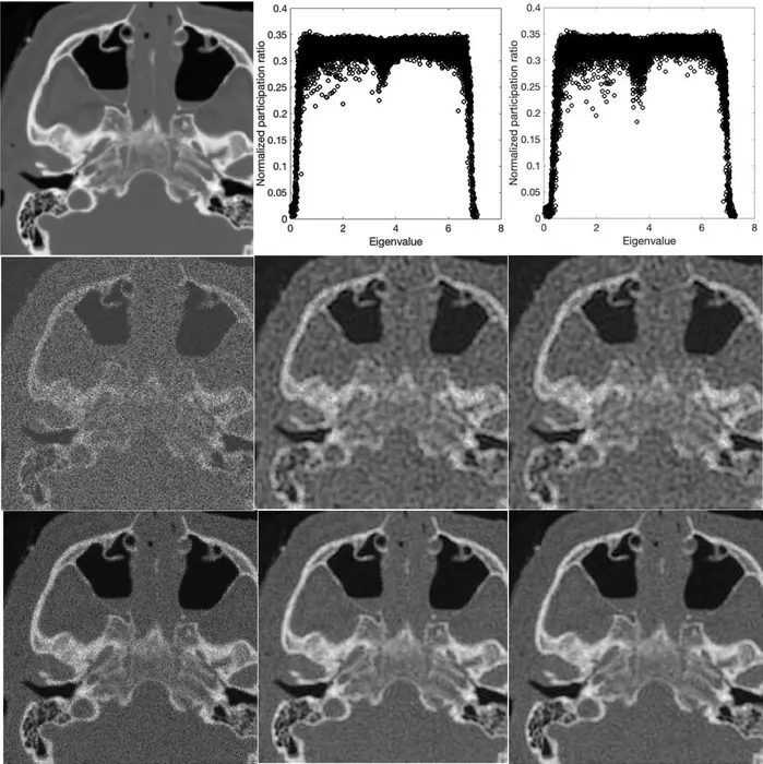 A medical image denoising method based on principles of quantum mechanics