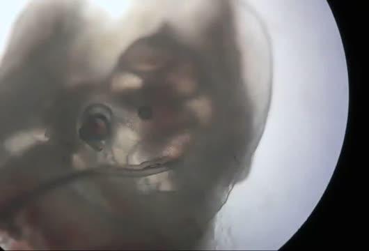 Wireless, Optical Cochlear Implant Uses LED Lights to Restore Hearing in Rodents (3 of 7)