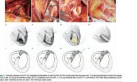 Repairing "Broken" Hearts