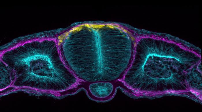 Neural tube