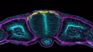 Neural tube