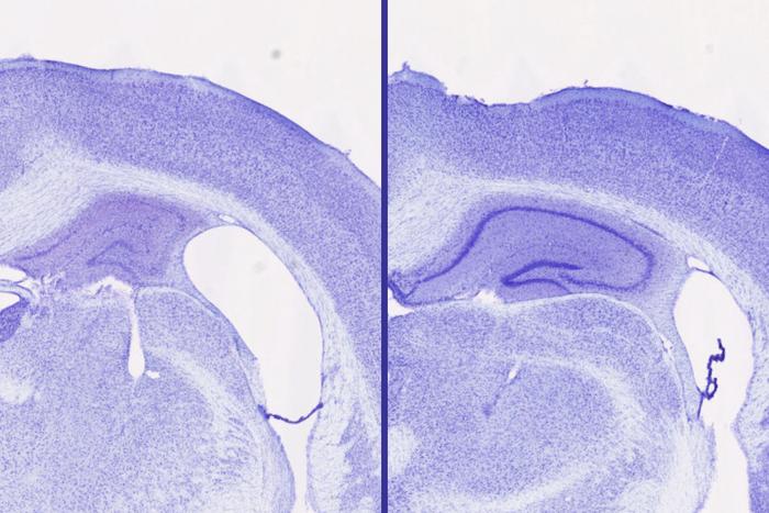 Sleep aid blocks neurodegeneration in mice