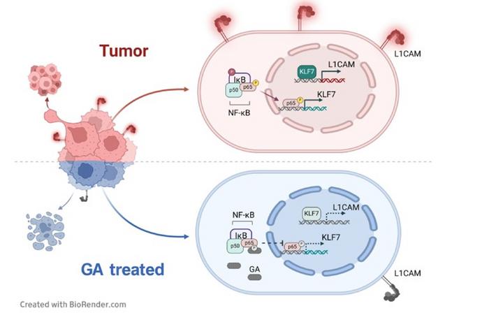 Gallic acid attenuates the malignant phenotype of prostate cancer cells by antagonizing NF-κB/KLF7/L1CAM expression