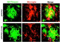 Confocal Images from the Hippocampal CA3 Region