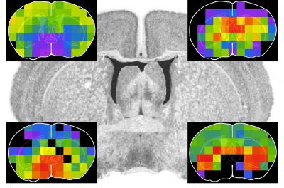 Brain Proteomics in 3-D