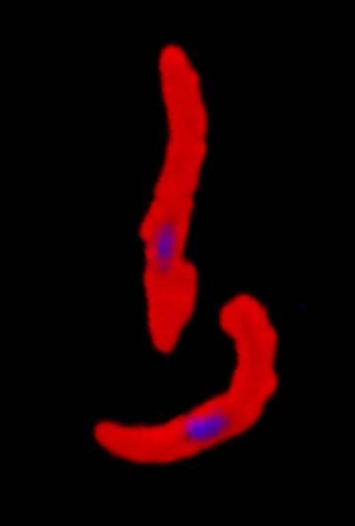Phase 1 Progress in the Quest for a Malaria Vaccine (1 of 3)