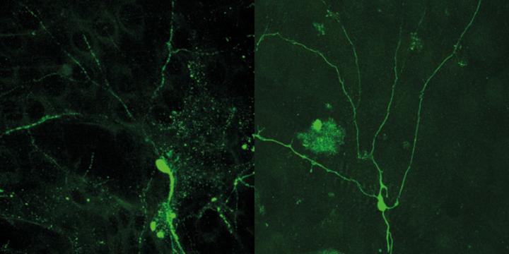 Nerve Cells