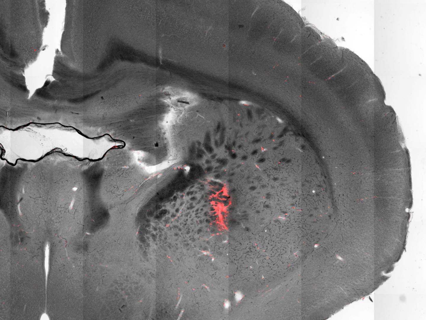 Magnetic Nanoparticles in the Brain