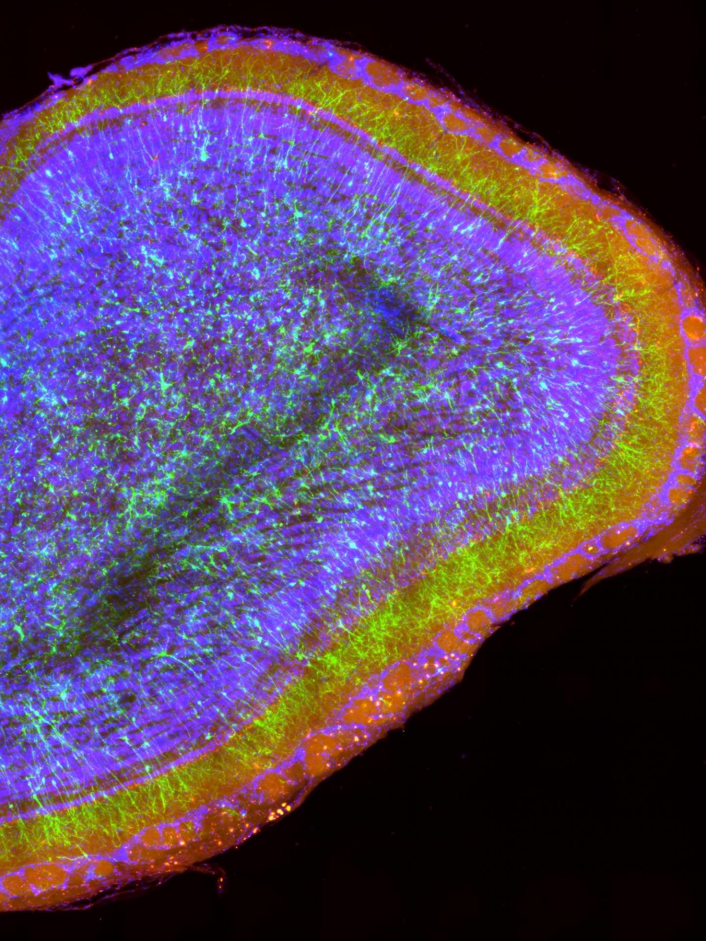 New Neurons in An Adult Brain